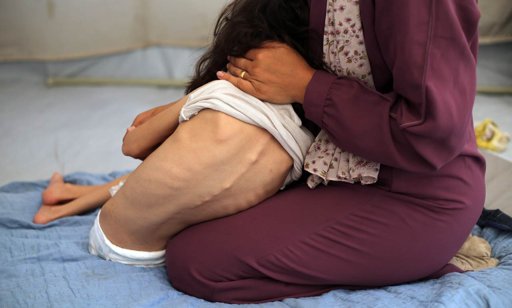 Declaración oficial de hambruna en Gaza por parte de la ONU
